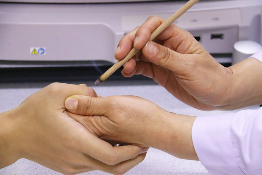 河南南阳：中医矫正视力忙_fororder_患者在南阳市中医院通过艾灸治疗近视 摄影 王小军.JPG