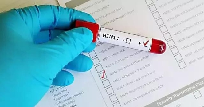 那么到底什么是H1N1？患者又会有哪些症状？_fororder_u=1270067770,4182556813&fm=173&s=93FA578477407B5FCC2E405A030090FA&w=640&h=335&img.JPEG