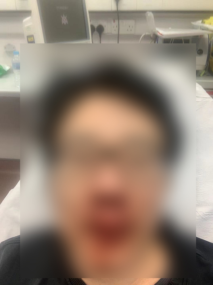 欧洲头条丨仇恨犯罪 英国又一华人遭到袭击