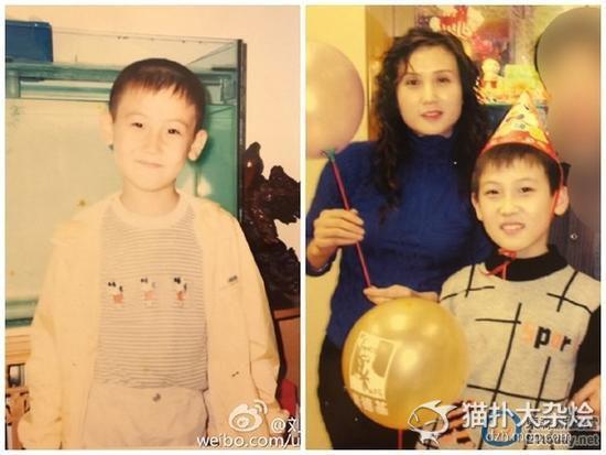 "蛇精男"晒儿时照引围观 15岁全脸整容吓坏人(图)