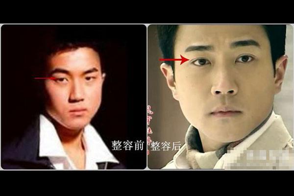 刘恺威整容前照片曝光 变化巨大获称假面小生