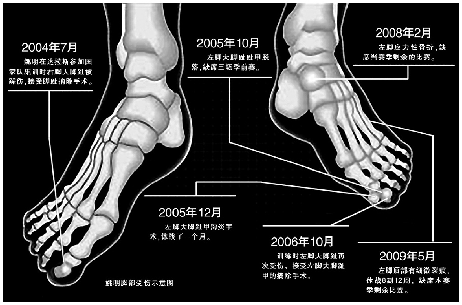 与NBA结缘的中国人:大郅成首人 周琦将接班?