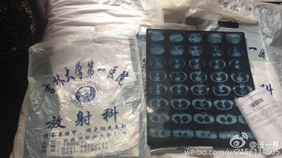 图片默认标题