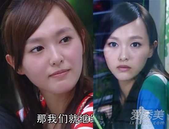 图揭唐嫣面部“硬伤” 龅牙+唇外翻+大脑门