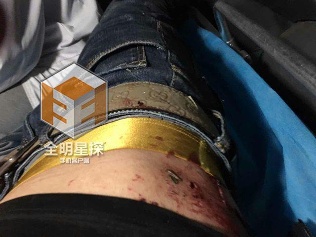 电影人西宁遭遇惨烈车祸 女演员不幸遇难