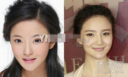 娱乐圈整容失败案例 11位女星越整越丑