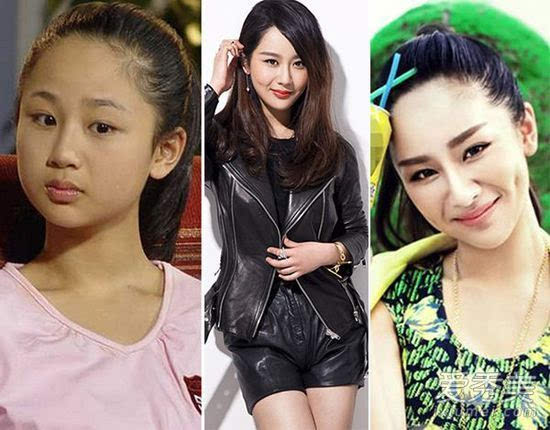 女明星整容后美哭了：杨紫赵丽颖张天爱变女神