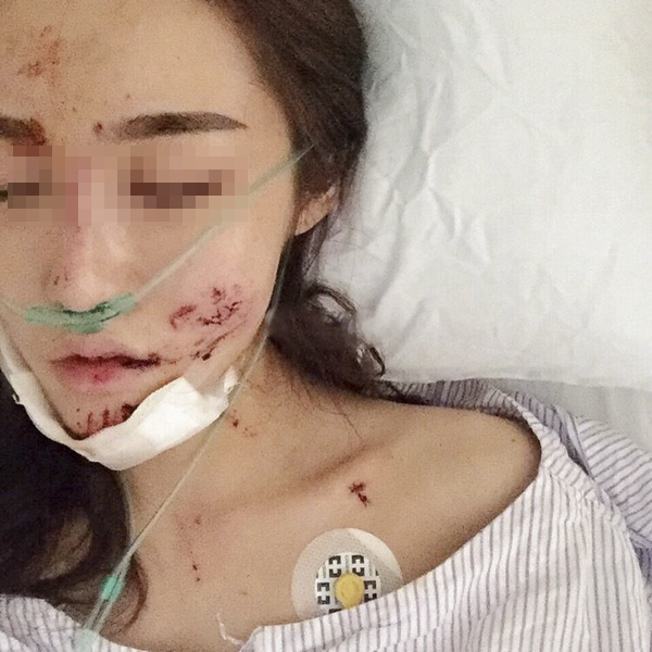 图片默认标题