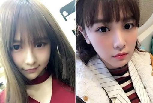 SNH48唐安琪谈烧伤真相 网友评论身边女伴被掩盖？