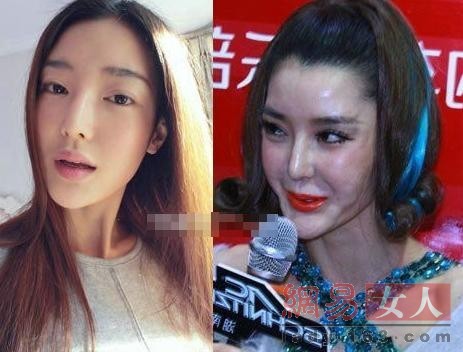 15岁萌妹整容成二次元蛇精 细数整容失败的女星(组图)