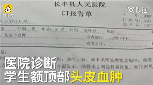 老师把学生打成"熊猫眼" 告知家长称只"碰了一下"