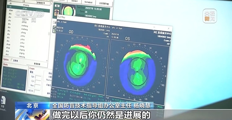 暑期当心视力“滑坡” 这份护眼指南请收好