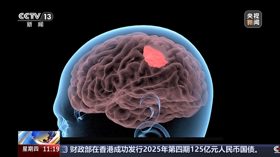 微米级“导航”实时监测脑神经 我国植入式脑机接口取得新突破