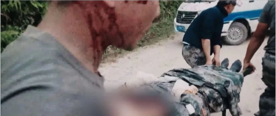 视频丨见到杜富国，张桂梅老师心疼得哭了