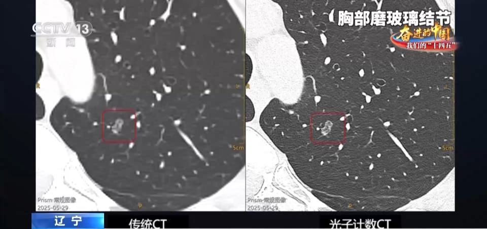 从“跟跑”到“领跑” 国产医疗装备“利器”层出