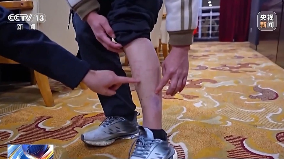 人被明码标价出售、完不成“任务”遭毒打……回流人员讲述明家犯罪集团累累罪行