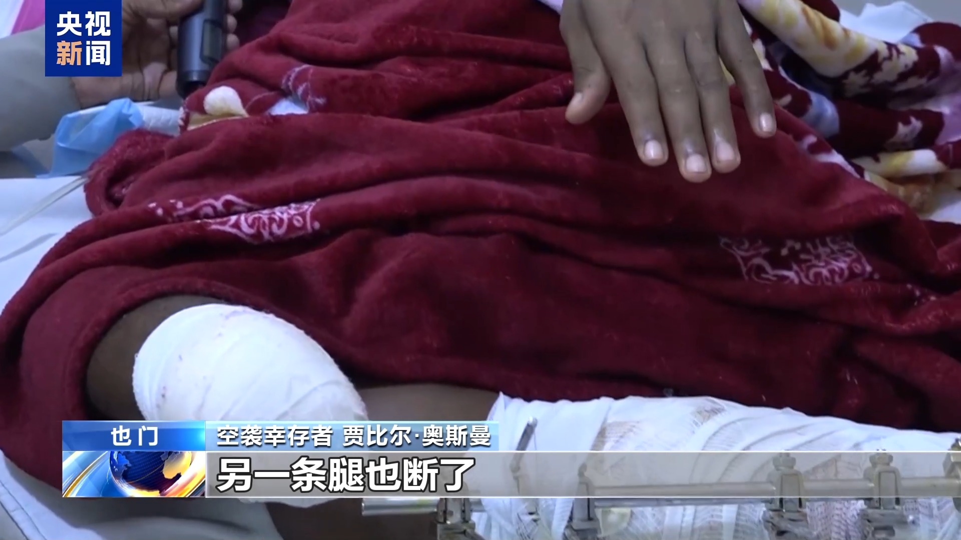 总台探访丨非洲移民拘留所遭袭 幸存者回忆“失去双腿”的绝望时刻