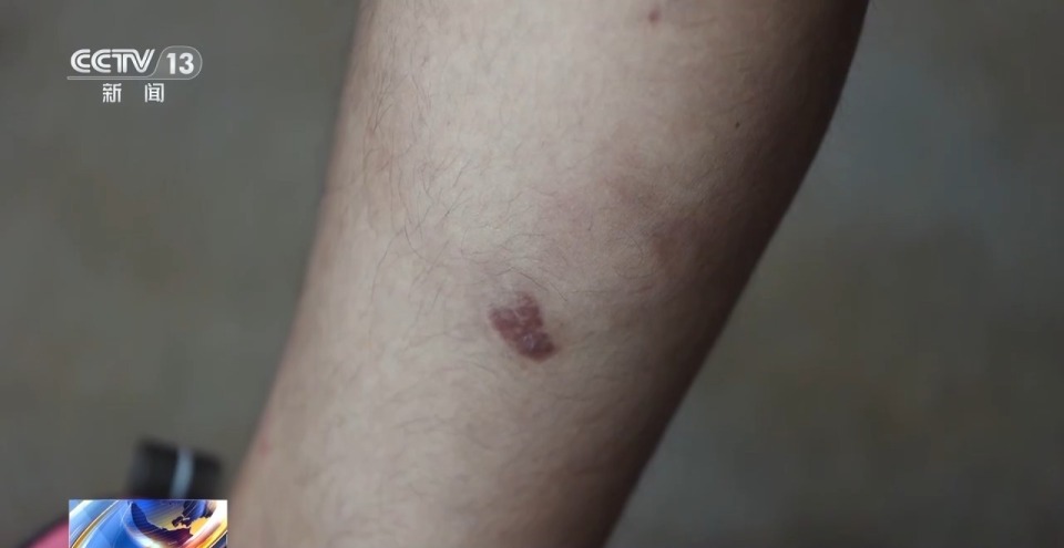 法治在线丨独家对话胡一啸及其父亲胡宗兵 揭秘缅北高薪淘金陷阱