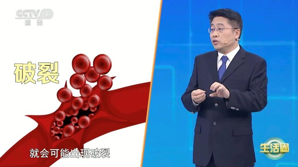 死亡“第一元凶”不是癌症而是它 两个方法帮你远离→