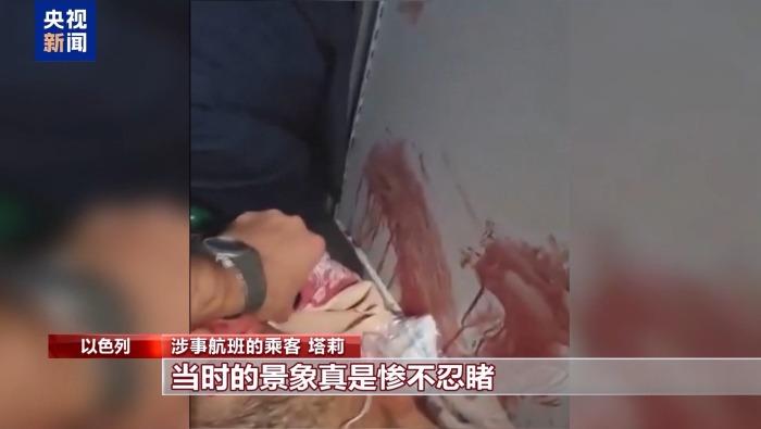 迪拜航空乘客回忆机上惊魂时刻：飞机一度急降 以为生命将终结