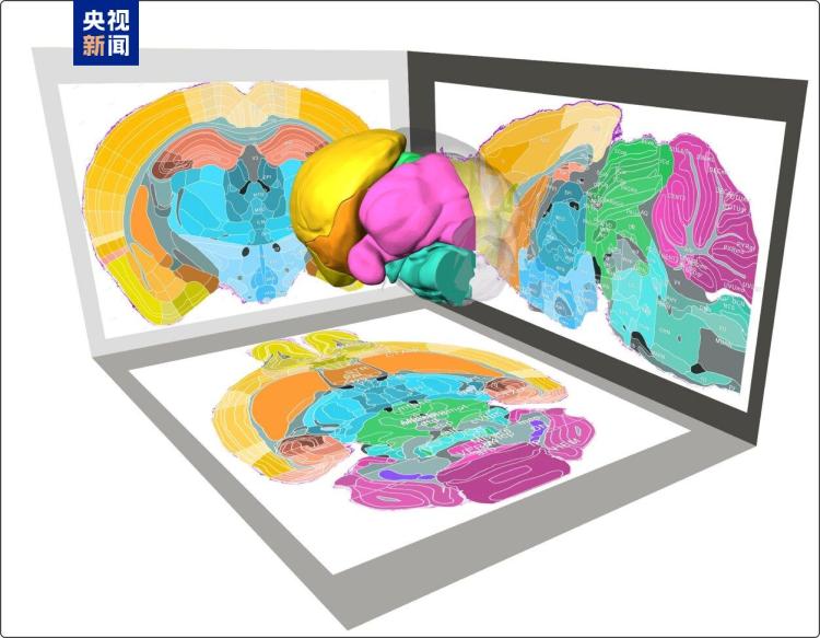 探索脑部奥秘 中国科学家有新进展