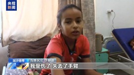联合国机构：加沙地带是现代历史上儿童截肢人数最多的地区